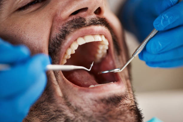 Best Laser Dentistry  in Mcloud, OK